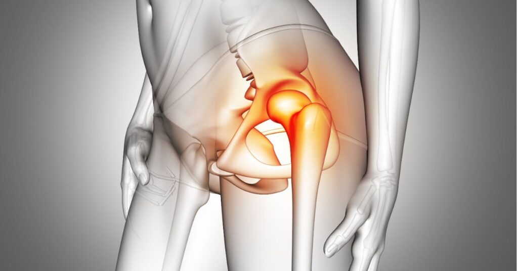 hip avn treatment in indore, best doctor for hip avn, nonoperative treatment for hip avn