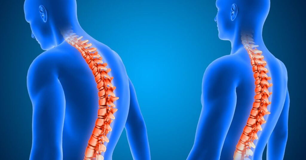 spine surgeon in indore, best spine surgeon in indore