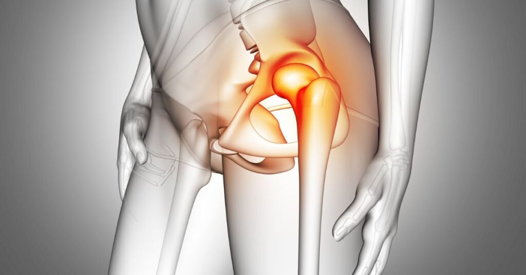 hip avn in indore