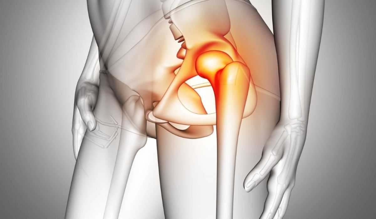 hip avn in indore