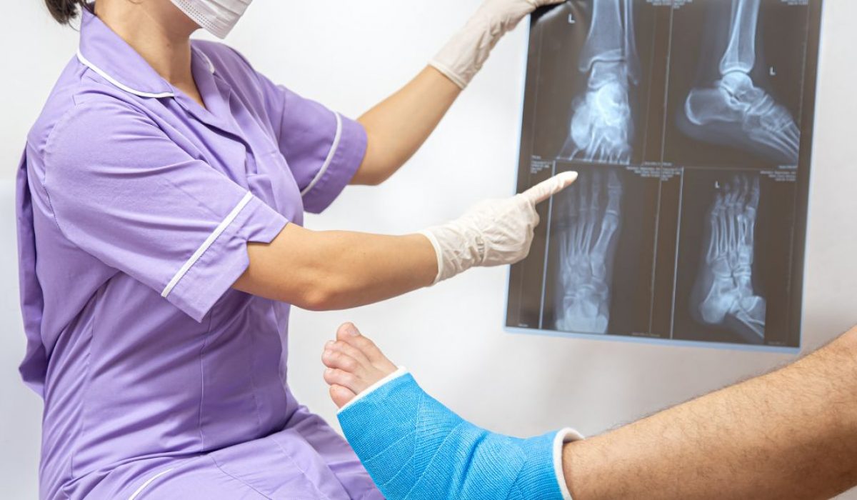 orthopaedic gfc treatment in indore, best orthopaedic gfc treatment in indore