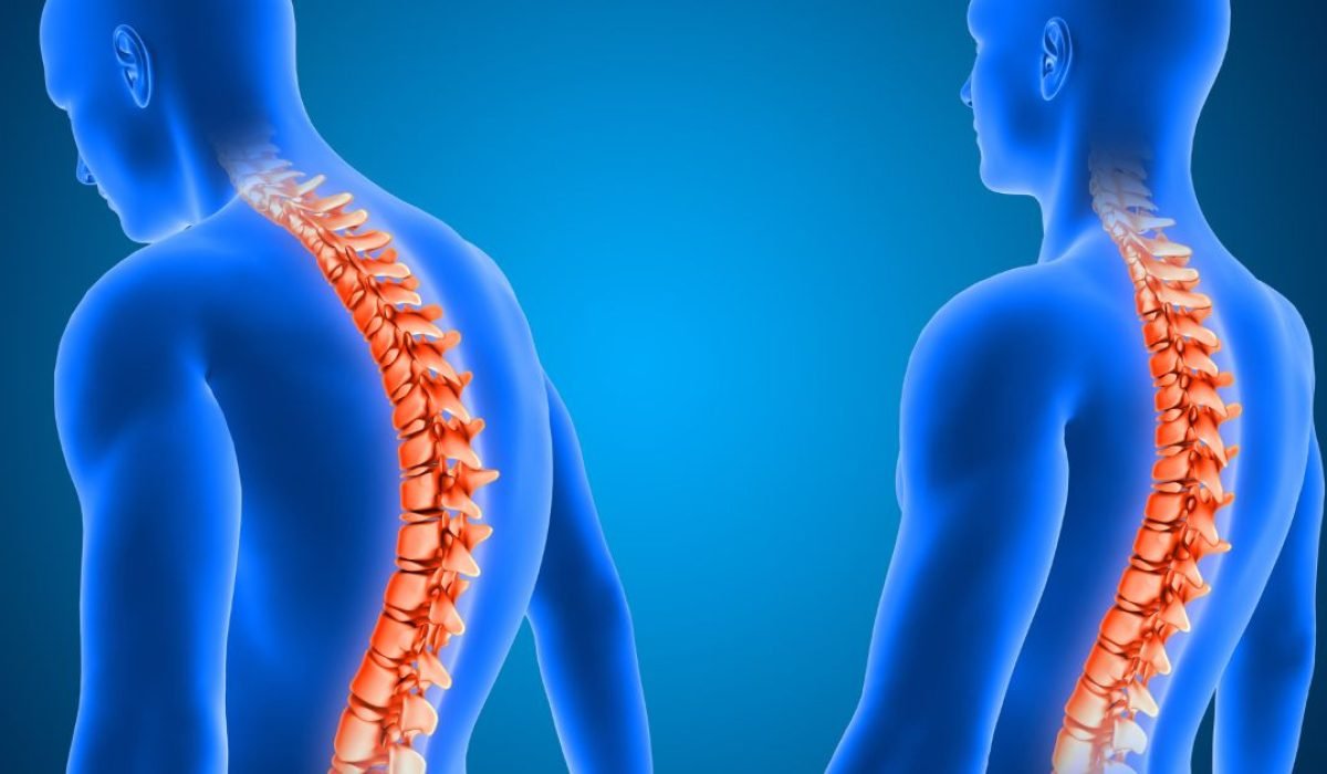 spine surgeon in indore, best spine surgeon in indore